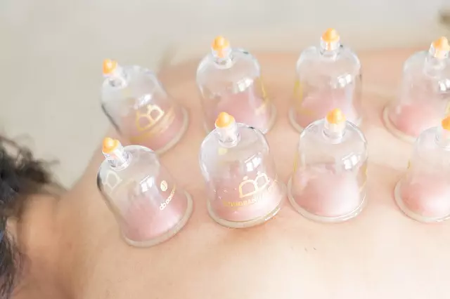 CoolSculpting Treatments
