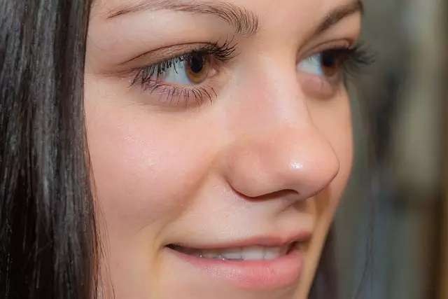 Facial Fillers