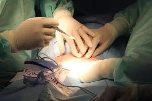 professional-botox-treatments-640x480-27526556.jpeg