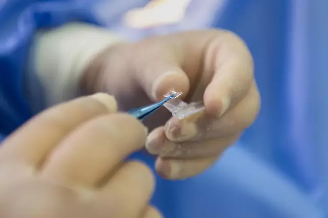 Professional Botox Treatments