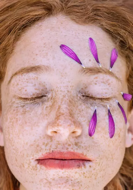 Skin Resurfacing Peels