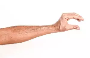 thigh-and-arm-fat-freezing-640x480-34498040.jpeg