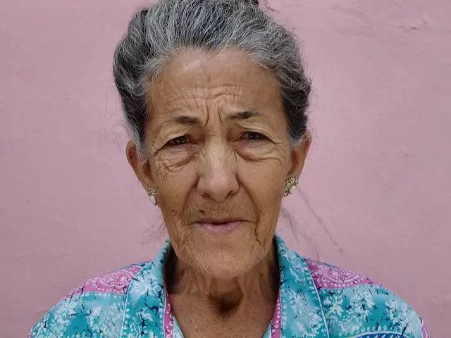 Wrinkle Reduction