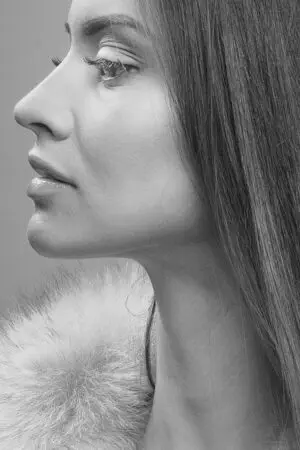 chin-fat-freezing-submental-coolsculptin-640x480-68230061.jpeg