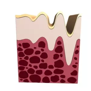 collagen-stimulation-640x480-52866074.jpeg