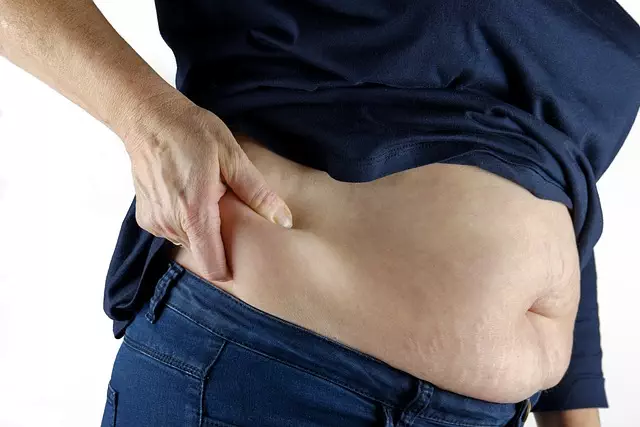 CoolSculpting belly treatment, stomach fat freezing, CoolSculpting abs