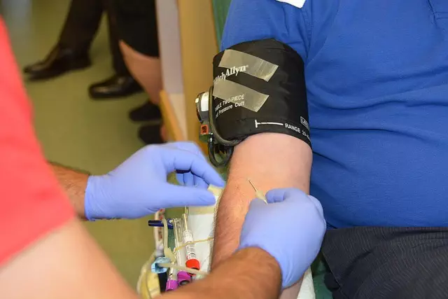CoolSculpting Procedure