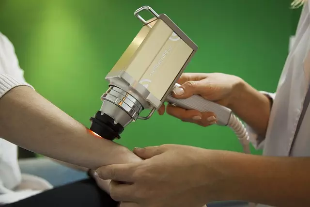 Laser Skin Treatments