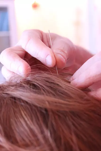 Morpheus8 Treatment Outcomes