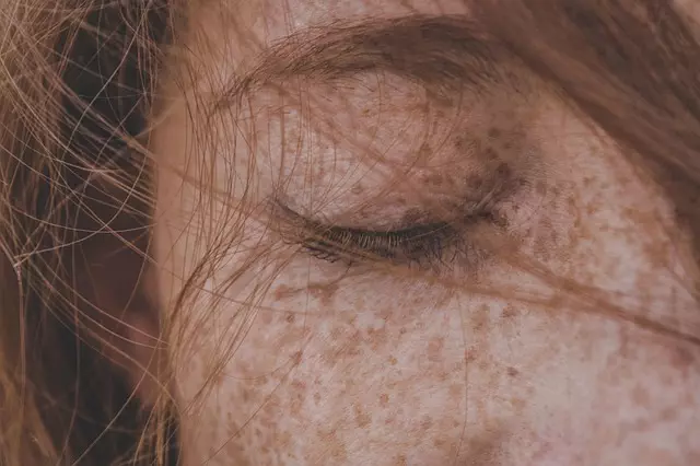 Non-Surgical Skin Tightening