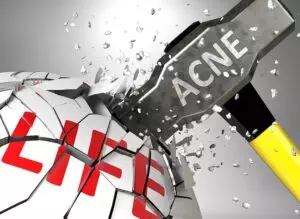 acne-scar-reduction-with-morpheus8-640x480-91186723.jpeg