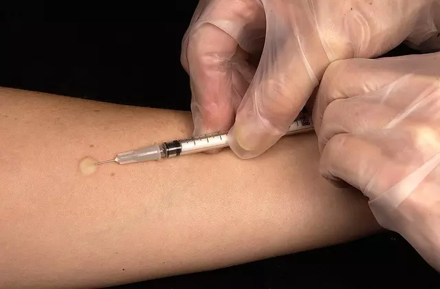 Botox Injections