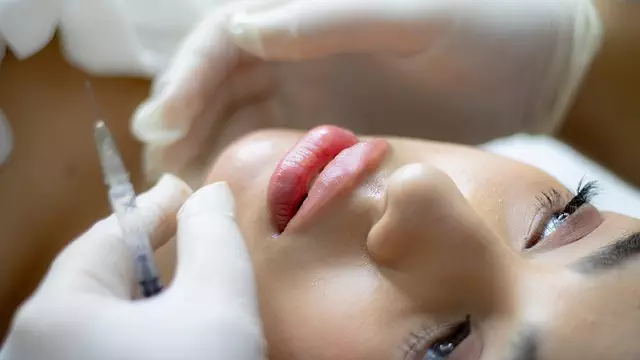 Botox vs Dermal Fillers
