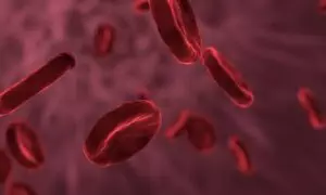 freeze-fat-cells-640x480-17279845.jpeg