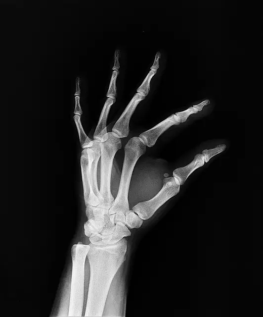 Liability Insurance