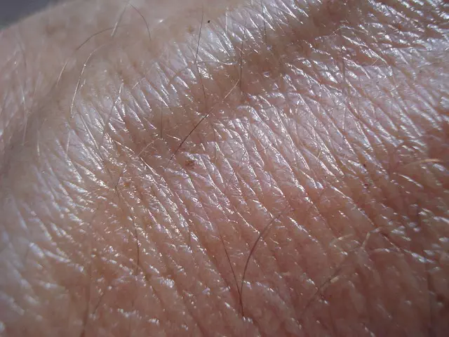 Skin Resurfacing Peels