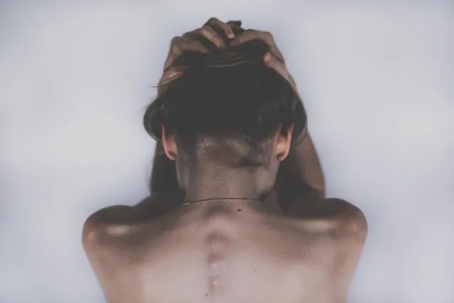 acupuncture for back pain