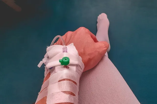 morpheus8-treatment-outcomes-640x480-66860715.jpeg