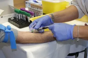 thigh-and-arm-fat-freezing-640x480-10290754.jpeg